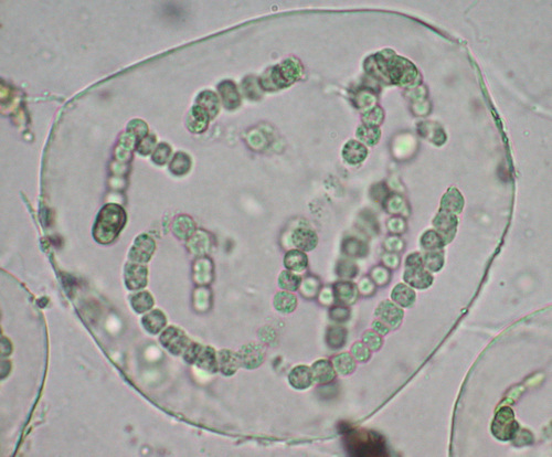 Nostoc (cyanobacteria) species - Free living, microscopic view